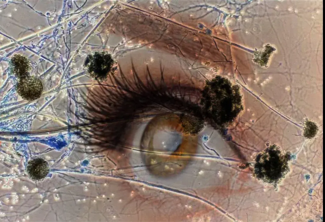 Feature Image